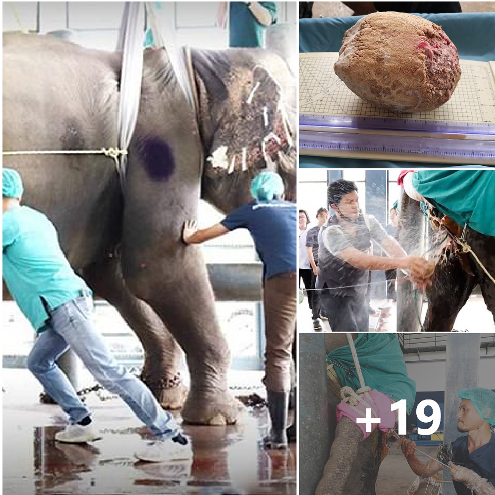 50 doctors, nurses and heavy cranes were mobilized to join the surgical team to remove a giant gallstone weighing 3.7 pounds from the gallbladder of a 50-year-old elephant after it collapsed due to severe abdominal pain.